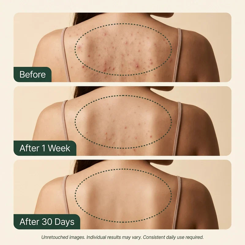 Calluve Tea Tree Body Clear Set