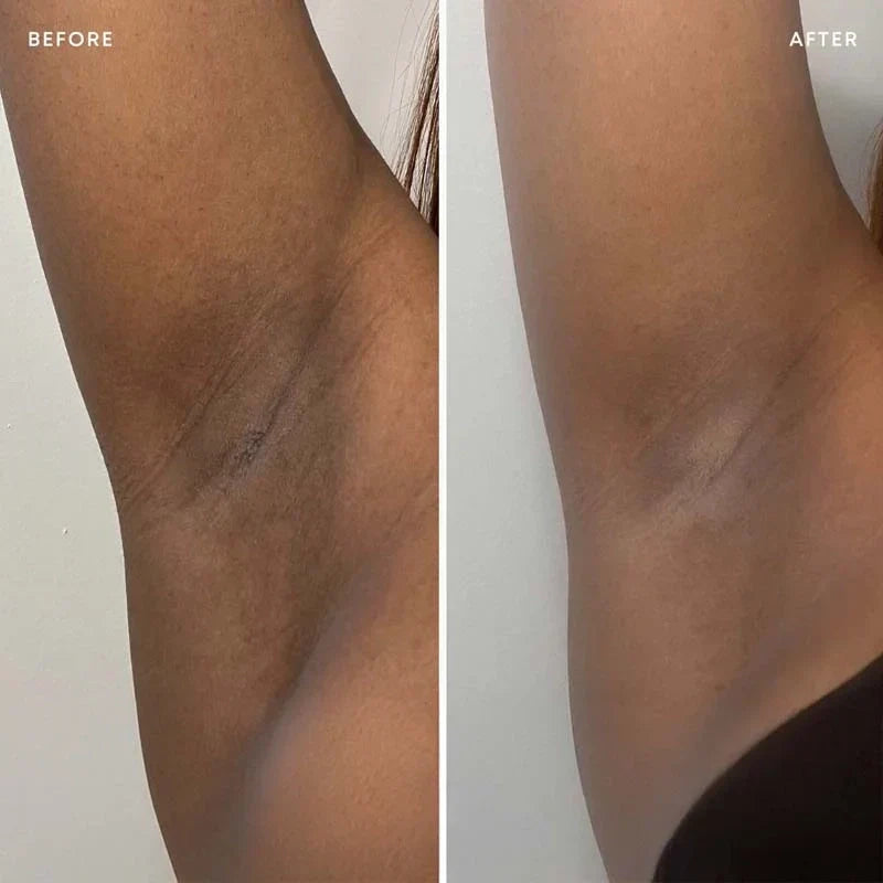 Calluve Turmeric + Kojic Acid Brightening Deodorant